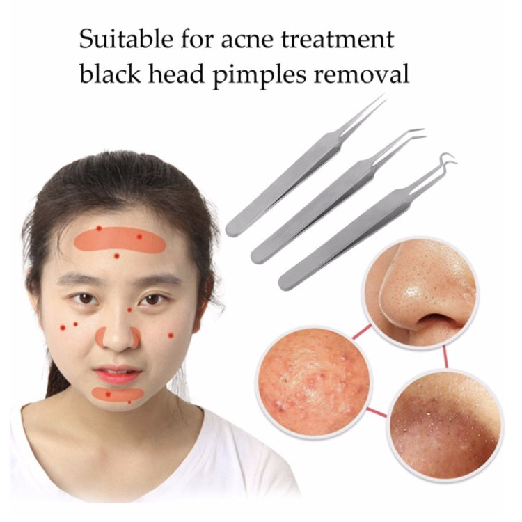 3pcs Acne Blackhead Tweezers | Needle Blemish Pimples Removal Pointed Bend Gib Head Face Care Tools Comedone - Boo & Bub